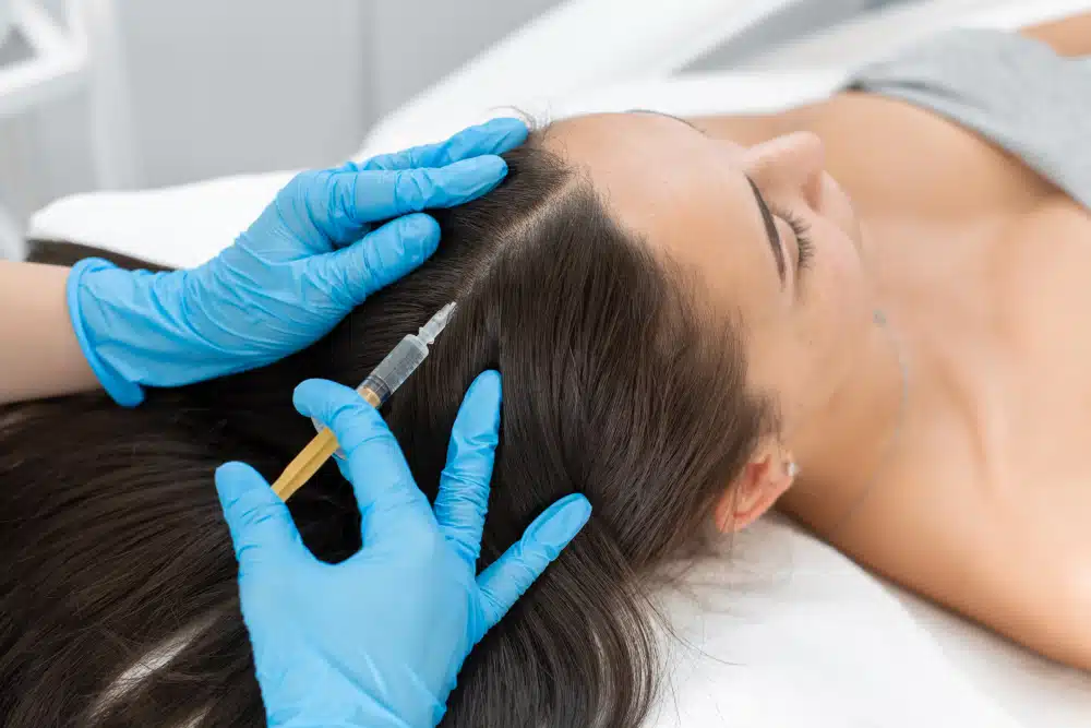 Dutasteride mesotherapy scalp injection procedure at Monarch MD West Vancouver