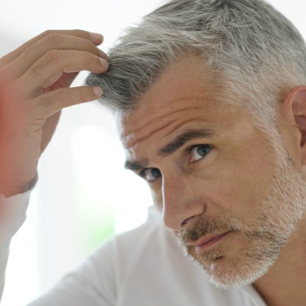 men hair transplant HAIR LOSS